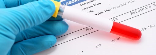 בדיקת רמת טרנספרין בדם (Transferrin) - תמונה